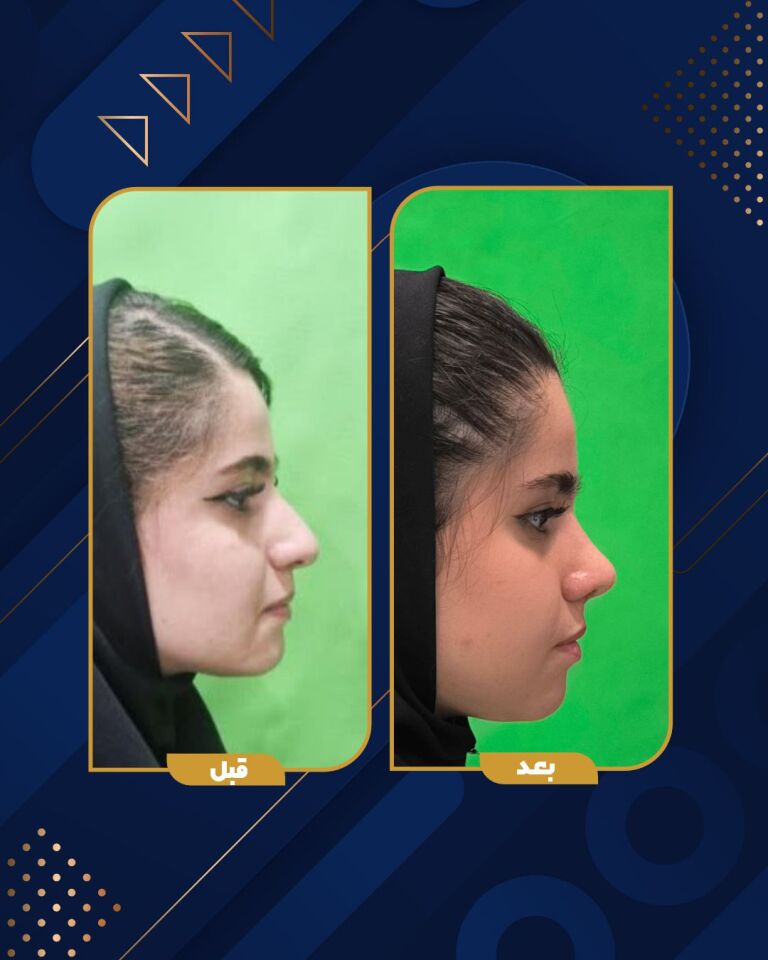 عمل زیبایی یزد 