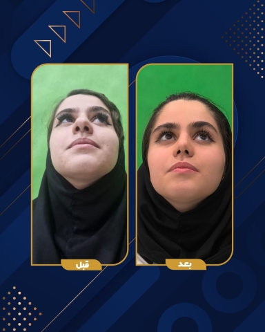 ویدیو کامل را با کلیک روی عکس مشاهده کنید 